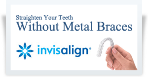 Todd Marby Invisalign