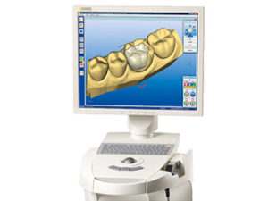 cerec