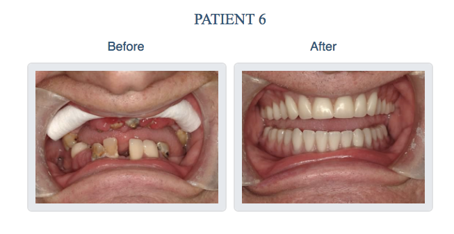 before and after pictures